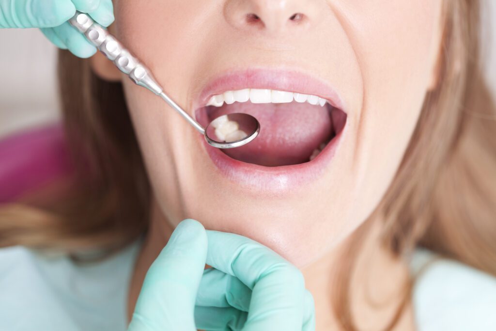 dental fillings vs. root canal treatment in Williamsburg, VA